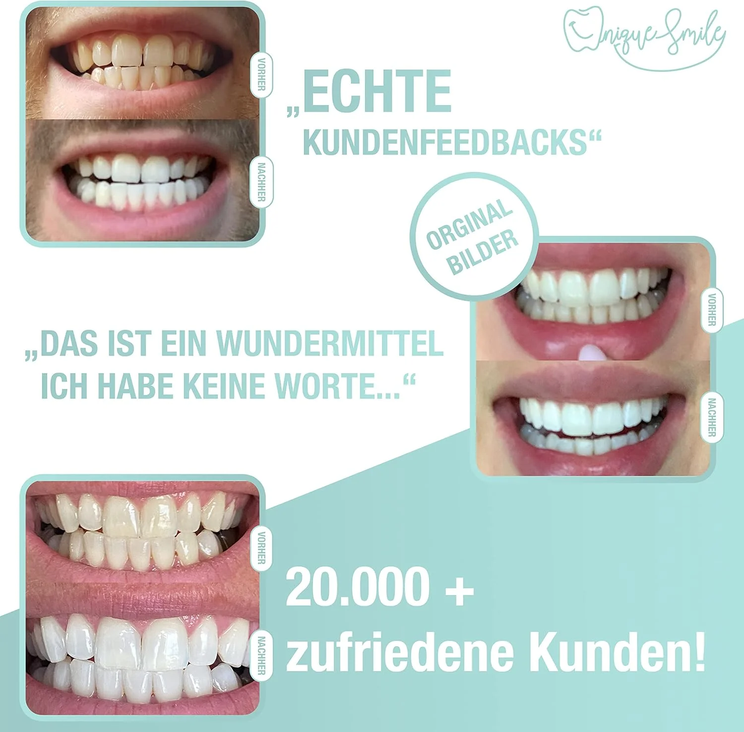 Hochwertiges Teeth whitening kit von UniqueSmile - All in One Bundle für Zahnaufhellung & weisse Zäh - Image 2